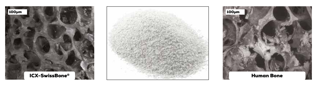 ICX-P5 Intraoral Scanner